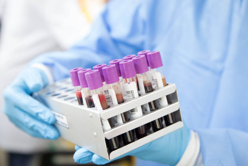 https://medicoanalytica.eu/kuidas-moista-laboritesti-tulemusi/